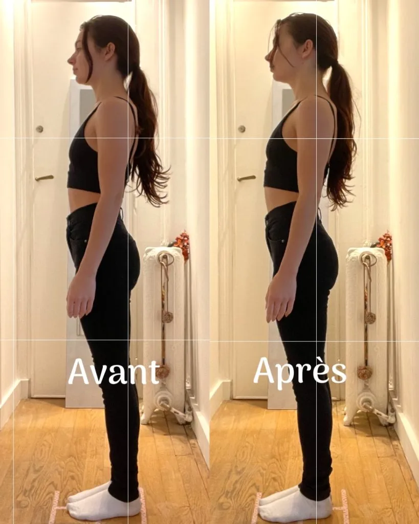 résultats avant/après méthode re-set